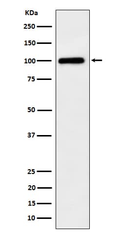 Western Blot: Desmocollin-1 Antibody (SR1004) [NBP3-22640] - Western blot analysis using NBP3-22640 in A375 cell lysate.