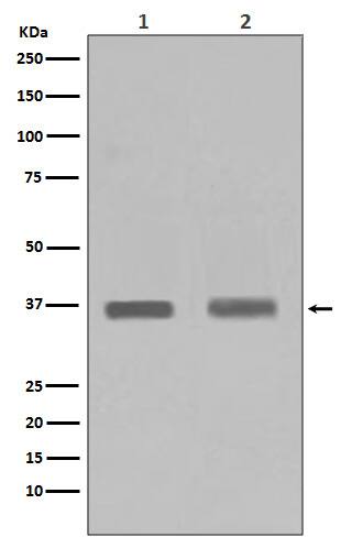 Western Blot: PP1 alpha/beta catalytic subunit Antibody (SR1625) [NBP3-22651] - Western blot analysis using NBP3-22651 in (1) Jurkat cell lysate; (2) HeLa cell lysate. 