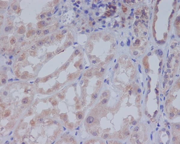 Immunohistochemistry: Acetyl-CoA Carboxylase Antibody (SR1412) [NBP3-22652] - Immunohistochemical analysis of paraffin-embedded human kidney, using NBP3-22652.