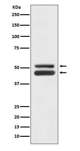 Western Blot JNK1/JNK2 Antibody (SR1786)