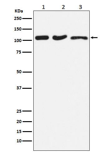 Western Blot: DISC1 Antibody (SR1013) [NBP3-22665] - Western blot analysis using NBP3-22665 in (1) HeLa cell lysate; (2) RAW264.7 cell lysate; (3) PC-12 cell lysate.