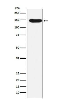 Western Blot-NBP3-22668-Desmoglein-3 Antibody (SR1165)-Analysis of Desmoglein 3 expression in A431 cell lysate.