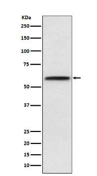 Western Blot-NBP3-22669-LCAT Antibody (SR1989)-Analysis of LCAT expression in Human plasma lysate.