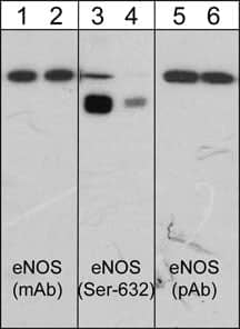 Western Blot: eNOS [p Ser632] Antibody (M232) [NBP3-23181] - Western blot analysis of human umbilical vein endothelial cells stimulated with Calyculin A and untreated (lanes 1, 3, 5) or treated (lanes 2, 4, 6) with lambda phosphatase. The blots were probed with anti-endothelial Nitric Oxide Synthase (eNOS) monoclonal antibody (lanes 1 & 2), anti-eNOS (Ser-632) phospho-specific antibody (lanes 3 & 4), and anti-eNOS polyclonal antibody (lanes 5 & 6).