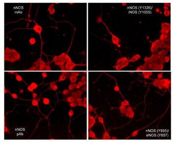 Immunocytochemistry/Immunofluorescence: eNOS [p Tyr657] Antibody [NBP3-23185] - Immunocytochemical labeling of nNOS phosphorylation in rat PC12 cells differentiated with NGF. The cells were probed with mouse monoclonal (mAb) nNOS (NBP3-23224), and rabbit polyclonal (pAb) nNOS (C-terminal region), nNOS (Tyr-895)/eNOS (Tyr-657), and nNOS (Tyr-1326)/iNOS (Tyr-1055). The antibodies were detected using appropriate secondary antibody conjugated to DyLight(R) 594.