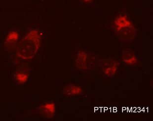 Immunocytochemistry/Immunofluorescence: PTP1B/PTPN1 Antibody (M234) [NBP3-23189] - Immunocytochemical labeling of PTP1B/PTPN1 in methanol and acetone fixed human NCI-H1915 lung carcinoma cells. The cells were labeled with mouse monclonal anti-PTP1B/PTPN1 (NBP3-23189) antibody. The antibody was detected using appropriate secondary antibody conjugated to DyLight(R) 594.
