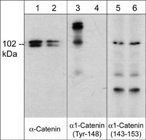 Western Blot: Catenin alpha 1 [p Tyr148] Antibody [NBP3-23196] - Western blot analysis of rat PC12 cells treated with pervanadate (1 mM) for 30 min (lanes 1, 3, & 5) then the blot was treated with alkaline phosphatase (lanes 2, 4, & 6). The blot was probed with anti- -Catenin monoclonal (lanes 1 & 2), anti-Catenin alpha 1 (Tyr-148) phospho-specific (lanes 3 & 4), or anti-Catenin alpha 1 (a.a. 143-153) (lanes 5 & 6).