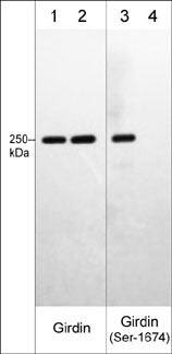 Western Blot: Girdin [p Ser1674] Antibody [NBP3-23205] - Western blot image of human A431 cell lysates treated with Calyculin A (lanes 1-4). The blot was treated with lambda phosphatase to dephosphorylate Girdin phosphosites (lanes 2 & 4). The blot was probed with mouse  monoclonal anti-Girdin (lanes 1 & 2)  or rabbit polyclonal anti-Girdin (Ser-1674), phospho-specific (lanes 3 & 4).