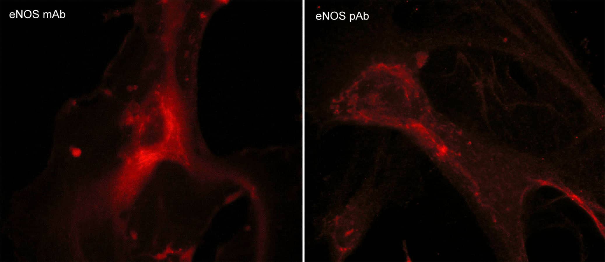 Immunocytochemistry/Immunofluorescence: eNOS Antibody (M221) [NBP3-23209] - Immunocytochemical labeling of endothelial nitric oxide synthase (eNOS) in paraformaldehyde-fixed and NP-40-permeabilized human umbilical vein endothelial cells. The cells were labeled with mouse monoclonal eNOS (NBP3-23209) and rabbit polyclonal eNOS (NBP3-23210) antibodies, then the antibodies were detected using appropriate secondary antibodies conjugated to Cy3.