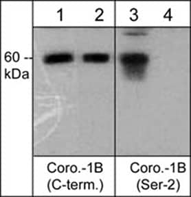 Western Blot: CORO1B Antibody [NBP3-23241] - Western blot analysis of human A431 cells  treated with Calyculin A (100 nM) for 30 min (lanes 1 & 3) before treatment with lambda phosphatase (lanes 2 & 4). The blots were probed with anti-CORO1B (C-terminal region) (lanes 1 & 2) and anti-CORO1B (Ser-2) (lanes 3 & 4).