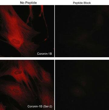 Immunocytochemistry/Immunofluorescence: CORO1B Antibody [NBP3-23241] - Immunocytochemical labeling of CORO1B in rabbit spleen fibroblasts treated with Calyculin A. The cells were labeled with rabbit polyclonal CORO1B (C-terminus) and CORO1B (Ser-2) antibodies, then detected using appropriate secondary antibodies conjugated to Cy3. The antibodies were used in the absence (left) or presence (right) of their respective blocking peptide.