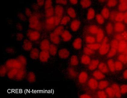 Immunocytochemistry/Immunofluorescence: CREB Antibody [NBP3-23243] - Immunocytochemical labeling of CREB in A431 that were fixed in paraformaldehyde and permeabilized using NP-40. The cells were labeled with rabbit polyclonal CREB (N-terminal region). The antibody was detected using goat anti-rabbit DyLight(R) 594.