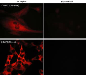 Immunocytochemistry/Immunofluorescence: CRMP2 Antibody [NBP3-23261] - Immunocytochemical labeling of phosphorylated CRMP2 in mouse C2C12 cells. The cells were probed with CRMP2 (C-terminal region) and CRMP2 (Thr-555) rabbit polyclonal antibodies, then the antibodies were detected using appropriate secondary antibodies conjugated to Cy3. The antibodies were used in the absence (left) or presence (right) of their respective blocking peptide.