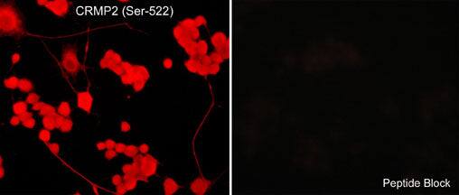 Immunocytochemistry/Immunofluorescence: CRMP2 [p Ser522] Antibody [NBP3-23262] - Immunocytochemical labeling of CRMP2 phosphorylation in aldehyde-fixed and NP-40-permeabilized NGF-differentiated PC12 cells. The cells were labeled with rabbit polyclonal anti-CRMP2 (Ser-522) (CP2191) antibody in the absence (Left) or presence (Right) of blocking peptide. The antibody was detected using appropriate secondary antibody conjugated to DyLight(R) 594.