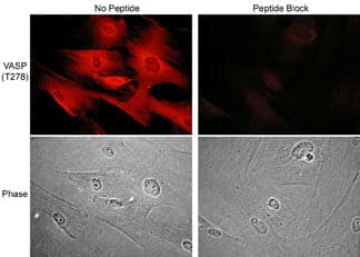 Immunocytochemistry/Immunofluorescence: VASP [p Thr278] Antibody [NBP3-23264] - Immunocytochemical labeling of VASP phosphorylation in rabbit spleen fibroblasts treated with Calyculin A. The cells were labeled with rabbit polyclonal VASP (Thr-278) antibody, then detected using appropriate secondary antibodies conjugated to Cy3. The antibody was used in the absence (top left) or presence (top right) of blocking peptide. Corresponding phase images are shown bottom left and right.