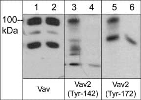 Western Blot: VAV2 Antibody [NBP3-23265] - Western blot of human A431 cells treated with EGF (lanes 1, 3, & 5) then the blot was exposed to alkaline phosphatase (lanes 2, 4, & 6). The blots were probed with anti-Vav (a.a. 165-174) (lanes 1 & 2), anti-VAV2 (Tyr-142) (lanes 3 & 4), or anti-VAV2 (Tyr-172) (lanes 5 & 6).