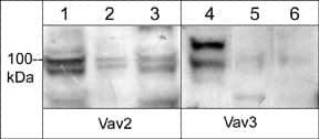 Western Blot: VAV2 Antibody [NBP3-23273] - Western blot of human Jurkat (lanes 1 & 4), HUVEC (lanes 2 & 5), and A431 (lanes 3 & 6) cells. The blots were probed with anti-VAV2 (a.a. 309-322) at a dilution of 1:500 (lanes 1-3) and anti-VAV3 (a.a. 293-305) at 1:500 (lanes 4-6).