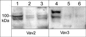 Western Blot: VAV3 Antibody [NBP3-23274] - Western blot of human Jurkat (lanes 1 & 4), HUVEC (lanes 2 & 5), and A431 (lanes 3 & 6) cells. The blots were probed with anti-VAV2 (a.a. 309-322) at a dilution of 1:500 (lanes 1-3) and anti-VAV3 (a.a. 293-305) at 1:500 (lanes 4-6).