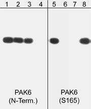 Western Blot: PAK6 Antibody [NBP3-23282] - Western blots of human PAK6 recombinant protein phosphorylated by ERK2. The blot was exposed to lambda phosphatase (lanes 2 & 6) then probed with anti-PAK6 (N-terminal) (lanes 1-4) or anti-PAK6 (Ser-165) phospho-specific (lanes 5-8). The antibodies were used in the presence of unrelated (lane 3) and PAK6 (N-terminal) (lane 4) peptide or PAK6 (Ser-165) (lane 7) and unrelated phospho-serine (lane 8) peptides, respectively.