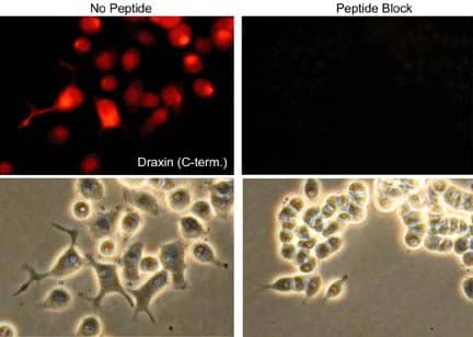 Immunocytochemistry/Immunofluorescence: Draxin/C1orf187 Antibody [NBP3-23287] - Immunocytochemical labeling of Draxin/C1orf187 in rat PC12 cells differentiated with NGF. The cells were probed with Draxin/C1orf187 (C-terminal region) rabbit polyclonal antibody, then the antibody was detected using appropriate secondary antibody conjugated to Cy3. The antibody was used in the absence (left) or presence (right) of blocking peptide. Lower images show corresponding phase images.