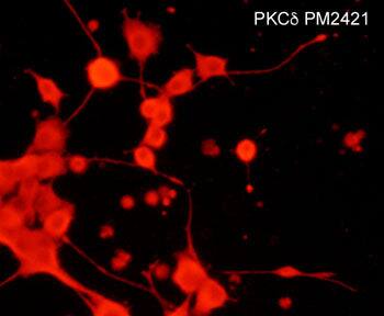 Immunocytochemistry/Immunofluorescence: PKC delta Antibody (M242) [NBP3-23307] - Immunocytochemical labeling of PKC delta in rat PC12 cells differentiated with NGF. The cells were labeled with mouse monoclonal PKC delta (N-terminal region) antibody, then detected using appropriate secondary antibody conjugated to Cy3.