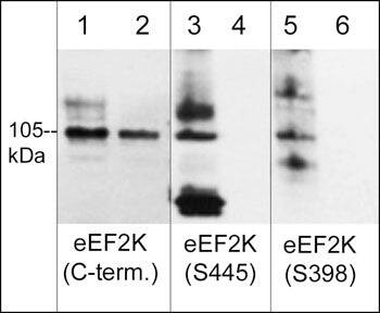 Western Blot: EEF2K [p Ser445] Antibody [NBP3-23311] - Western blot image of human Jurkat cells  treated with calyculin A (100 nM) for 30 min. (lanes 1-6), then some lanes of the blot were treated with lambda phosphatase (lanes 2, 4 & 6). The blot was probed with rabbit polyclonals anti-EEF2K (C-terminus) (lanes 1 & 2), anti-EEF2K (Ser-445) phospho-specific (lanes 3 & 4), and anti-EEF2K (Ser-398) phospho-specific (lanes 5 & 6).