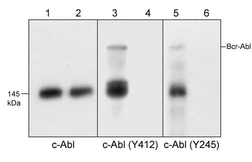 Western Blot: c-Abl Antibody (M209) [NBP3-23312] - Western blot analysis of K-562 cells treated with pervanadate (1 mM) for 30 minutes (lanes 1, 3, & 5). Some lanes were treated with alkaline phosphatase to remove phosphorylation on c-Abl (lanes 2, 4, & 6), then the blots were probed with anti-c-Abl (lanes 1 & 2), anti-c-Abl (Tyr-412) (NBP3-23318; lanes 3 & 4), or anti-c-Abl (Tyr-245) (NBP3-23313; lanes 5 & 6).