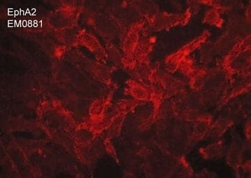 Immunocytochemistry/Immunofluorescence: EphA2 Antibody (M088) [NBP3-23321] - Immunocytochemical labeling of EphA2 in aldehyde fixed human MDA-MB-231 breast carcinoma cells. The cells were labeled with mouse monoclonal anti-EphA2 (NBP3-23321). The antibody was detected using goat anti-mouse DyLight(R) 594.