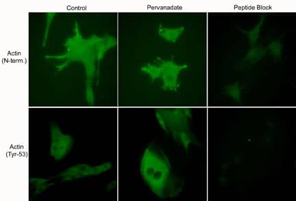 Immunocytochemistry/Immunofluorescence: beta-Actin [p Tyr53] Antibody [NBP3-23323] - Immunocytochemical labeling using anti-Actin (N-terminal) and anti-Actin (Tyr-53) polyclonal antibodies in C2C12 cells control (left) or treated with pervanadate (1 mM) for 30 min (middle). The cells were fixed in paraformaldehyde and permeabilized in acetone. Both antibodies were used in the presence of blocking peptide: Actin (N-terminal) peptide or phospho-Actin (Tyr-53) peptide, respectively (right).