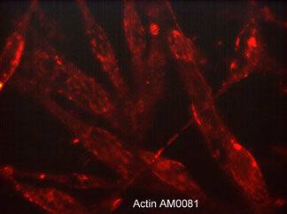 Immunocytochemistry/Immunofluorescence: beta-Actin Antibody (M008) [NBP3-23324] - Immunocytochemical labeling of beta-Actin in paraformaldehyde fixed human MeWo cells. The cells were labeled with mouse monoclonal anti-beta-Actin (clone M008). The antibody was detected using goat anti-mouse DyLight (R) 594.