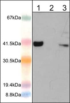 Western Blot: AIM2 Antibody [NBP3-23347] - Western blot analysis of human Jurkat cells (lane 1), mouse macrophages untreated (lane 2) and treated (lane 3) with IFN gamma (10 ng/ml) and LPS (1ug/ml) for 12 hr (20 ug/lane). The blot was probed with rabbit polyclonal anti-AIM2 (N-terminal region) antibody at 1:1000.