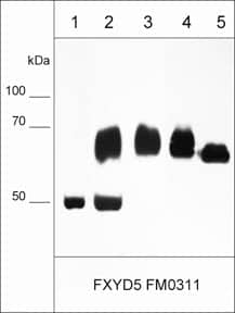 Western Blot: FXYD5/Dysadherin Antibody (M031) [NBP3-23350] - Western blot analysis of FXYD5 protein expression. Immunoprecipitates using FXYD5/Dysadherin antibody (NBP3-23350) only (lane 1) or NBP3-23350 with A431 lysate (lane 2) or A431 input only (lane 3). Human cell lysates MDA-MB-231 (lane 4) or MeWo (lane 5). The blot was probed with mouse monoclonal FXYD5/Dysadherin at 1:1000.