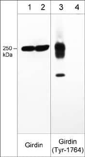 Western Blot Girdin Antibody (M012)