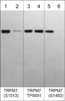 Western Blot: TRPM7 Antibody [NBP3-23362] - Western blot image of human autophosphorylated TRPM7 C-terminal kinase domain (lanes 1-6). The blot was treated with lambda phosphatase to dephosphorylate TRPM7 phosphosites (lanes 2, 4, & 6). The blot was probed with rabbit polyclonals anti-TRPM7 (Ser-1513) phospho-specific (lanes 1 & 2), anti-TRPM7 (a.a.1484-1497) NBP3-23362 antibody (lanes 3 & 4), or anti-TRPM7 (Ser-1493) phospho-specific (lanes 5 & 6).