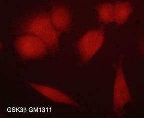 Immunocytochemistry/Immunofluorescence: GSK-3 beta Antibody (M131) [NBP3-23366] - Immunocytochemical labeling of GSK-3 beta in aldehyde-fixed and NP-40 permeabilized human NCI-H1915 lung carcinoma cells. The cells were labeled with mouse monoclonal anti-GSK-3 beta (NBP3-23366) antibody. The antibody was detected using appropriate secondary antibody conjugated to DyLight(R) 594.