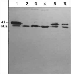 Western Blot: actin-related protein 2/3 complex subunit 1B Antibody [NBP3-23370] - Western blot of rat A7r5 (lane 1), human Jurkat (lane 2), rat PC12 (lane 3), human PC3 (lane 4), mouse C2C12 (lane 5), and human A431 cells (lane 6). The blot was probed with rabbit polyclonal anti-Arpc1b (C-terminal region).