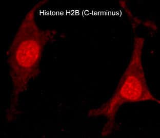 Immunocytochemistry/Immunofluorescence: Histone H2B type 1B Antibody [NBP3-23376] - Immunocytochemical labeling of Histone H2B type 1B in methanol and acetone fixed rat A7r5 cells. The cells were labeled with rabbit polyclonal Histone H2B type 1B (C-terminus) antibody (NBP3-23376), then the antibody was detected using appropriate secondary antibody conjugated to DyLight(R) 594.