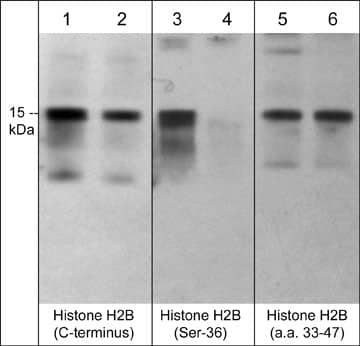 Western Blot: Histone H2B type 1B Antibody [NBP3-23377] - Western blot analysis of human Jurkat cells treated with calyculin A (100 nM) for 30 min. (lanes 1, 3, & 5) then the blots were treated with lambda phosphatase (lanes 2, 4, & 6). The blots were probed with anti-Histone H2B type 1B (C-terminus) (lanes 1 & 2), anti-Histone H2B type 1B (Ser-36) (lanes 3 & 4), and anti-Histone H2B type 1B (a.a. 33-47) (lanes 5 & 6).