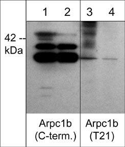 Western Blot: actin-related protein 2/3 complex subunit 1B [p Thr21] Antibody [NBP3-23382] - Western blot analysis of Arpc1b phosphorylation in human A431 stimulated with calyculin A (100 nM) for 30 min (lanes 1 & 3). The blots were treated with lambda phosphatase to remove phosphorylation (lanes 2 & 4), then probed with anti-Arpc1b (C-terminal region) (lanes 1 & 2) or anti-Arpc1b (Thr-21) (lanes 3 & 4).