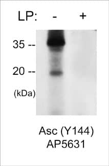 Western Blot: ASC/TMS1 [p Tyr144] Antibody [NBP3-23383] - Western blot analysis of mouse macrophage J774A.1 cells stimulated with pervanadate (1 mM for 30 min.), then untreated (-) or treated (+) with alkaline phosphatase. The blot was probed with rabbit polyclonal anti-ASC/TMS1 (Tyr-144) phospho-specific antibody (NBP3-23383) at 1:500.