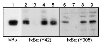 Western Blot: IkB-alpha [p Tyr305] Antibody [NBP3-23390] - Western blot analysis of A431 cells treated with pervanadate (1 mM) for 30 min. Blots were probed with anti-IkB-alpha (lane 1), anti-IkB-alpha (Tyr-42) (NBP3-23389; lanes 2-5), or anti-IkB-alpha (Tyr-305) (NBP3-23390; lanes 6-9). In some lanes, the antibodies were used in the absence (lane 2 & 6) or presence of IkB-alpha (Tyr-42) (lane 3 & 8) or IkB-alpha (Tyr-305) (lane 4 & 7) blocking peptides, or BSA conjugated to phospho-tyrosine (lane 5 & 9).