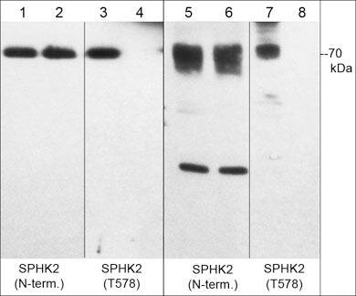 Western Blot: Sphingosine Kinase 2/SPHK2 [p Thr578] Antibody [NBP3-23393] - Western blot of human recombinant Sphingosine Kinase 2/SPHK2 (lanes 1-4) and HeLa treated with calyculin A (lanes 5-8). The blots were untreated (lane 1, 3, 5 & 7) or treated with lambda phosphatase (lane 2, 4, 6 & 8), then probed with anti-Sphingosine Kinase 2/SPHK2 (N-terminal region) (lanes 1, 2, 5 & 6) or anti-Sphingosine Kinase 2/SPHK2 (Thr-578) (lanes 3, 4, 7, & 8).