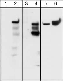 Western Blot: Integrin beta 4/CD104 Antibody (M126) [NBP3-23396] - Western blot analysis of A431 cells serum starved overnight (lanes 1, 3, & 5) and treated with pervanadate (1 mM) for 30 min (lanes 2, 4, & 6). The blots were probed with rabbit polyclonal anti-Integrin beta 4/CD104 (Tyr-1526) (lanes 1 & 2) and anti-Integrin beta 4/CD104 (Tyr-1494) (lanes 3 & 4) or with mouse monoclonal anti-Integrin beta 4/CD104  (lanes 5 & 6).