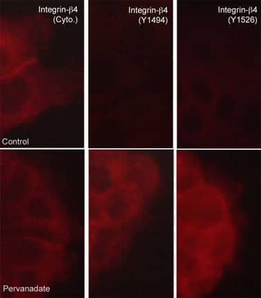 Immunocytochemistry/Immunofluorescence: Integrin beta 4/CD104 Antibody (M126) [NBP3-23396] - Immunocytochemical labeling of Integrin beta 4/CD104 in control (Top) and pervanadate-treated A431 cells (Bottom). The cells were labeled with mouse monoclonal anti-Integrin beta 4/CD104 (Cytoplasmic region) (left)  or rabbit polyclonals anti-Integrin beta 4/CD104 (Tyr-1494) (middle) or anti-Integrin beta 4/CD104 (Tyr-1526) (right), then the antibodies were detected using appropriate secondary antibodies conjugated to DyLight(R) 594.