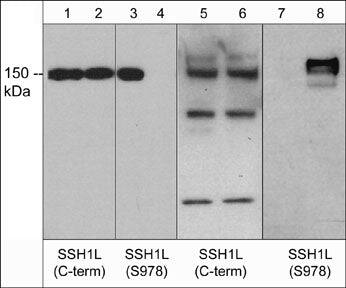 Western Blot: SSH1 Antibody [NBP3-23410] - Western blot of human recombinant SSH1 untreated (lanes 1 & 3) or treated with lambda phosphatase (lanes 2 & 4) and rat PC12 cells unstimulated (lanes 5 & 7) or stimulated with calyculin A (lanes 6 & 8). The blots were probed with anti-SSH1 (C-term.) (lanes 1, 2, 5, & 6) or anti-SSH1 (Ser-978) (lanes 3, 4, 7, & 8).