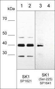 Western Blot: Sphingosine Kinase 1/SPHK1 [p Ser225] Antibody [NBP3-23421] - Western blot of HeLa stimulated with calyculin A (lanes 1-4). The blots were untreated (lane 1 & 3) or treated with lambda phosphatase (lane 2 & 4), then probed with anti-Sphingosine Kinase 1/SPHK1 (Central region) NBP3-23415 (lanes 1 & 2) or anti-Sphingosine Kinase 1/SPHK1 (Ser-225) NBP3-23421 (lanes 3 & 4).