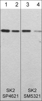 Western Blot: Sphingosine Kinase 2/SPHK2 Antibody (M532) [NBP3-23422] - Western blot of human recombinant Sphingosine Kinase 2/SPHK2 (lanes 1-4). The blots were probed with rabbit polyclonal anti-Sphingosine Kinase 2/SPHK2 (N-terminal region) at 1:250 (lane 1) and 1:1000 (lane 2) or with mouse monoclonal anti-Sphingosine Kinase 2/SPHK2 (N-terminal region) at 1:250 (lane 3) or 1:1000 (lane 4).
