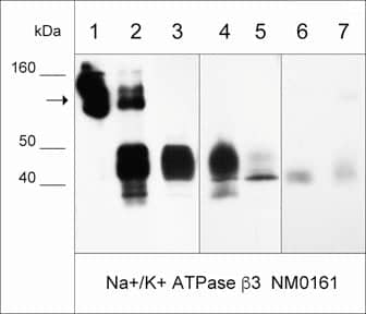 Western Blot: ATPase Na+/K+ beta 3 Antibody (M016) [NBP3-23433] - Western blot of NBP3-23433 immunoprecipitates (IP) and whole lysates. The NBP3-23433 antibody only (lane 1), IP from A431 cell lysate (lane 2), A431 cell input (lane 3), LNCaP cells (lane 4), MeWo cells (lane 5), and normal human lung (lane 6) and skin (lane 7). The blot was probed with anti-ATPase Na+/K+ beta 3 NBP3-23433 (lanes 1-7). The arrow designates native antibody, while the beta 3 subunit migrates around 40 kDa.