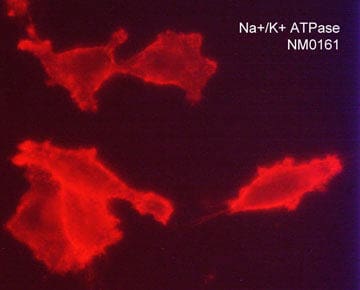 Immunocytochemistry/Immunofluorescence: ATPase Na+/K+ beta 3 Antibody (M016) [NBP3-23433] - Immunocytochemical labeling of ATPase Na+/K+ beta 3 in paraformaldehyde fixed human MDA-MB-231 cells. The cells were labeled with mouse monoclonal anti-ATPase Na+/K+ beta 3 (clone M016). The antibody was detected using goat anti-mouse Ig DyLight(R) 594.