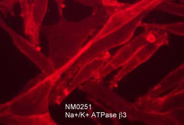 Immunocytochemistry/Immunofluorescence: ATPase Na+/K+ beta 3 Antibody (M025) [NBP3-23434] - Immunocytochemical labeling of ATPase Na+/K+ beta 3 in paraformaldehyde fixed human MeWo melanoma cells. The cells were labeled with mouse monoclonal anti-ATPase Na+/K+ beta 3 (clone M025). The antibody was detected using goat anti-mouse Ig DyLight(R) 594.